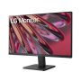 LG 24MR400-B IPS FHD 100Hz AMD FreeSync - slika 3